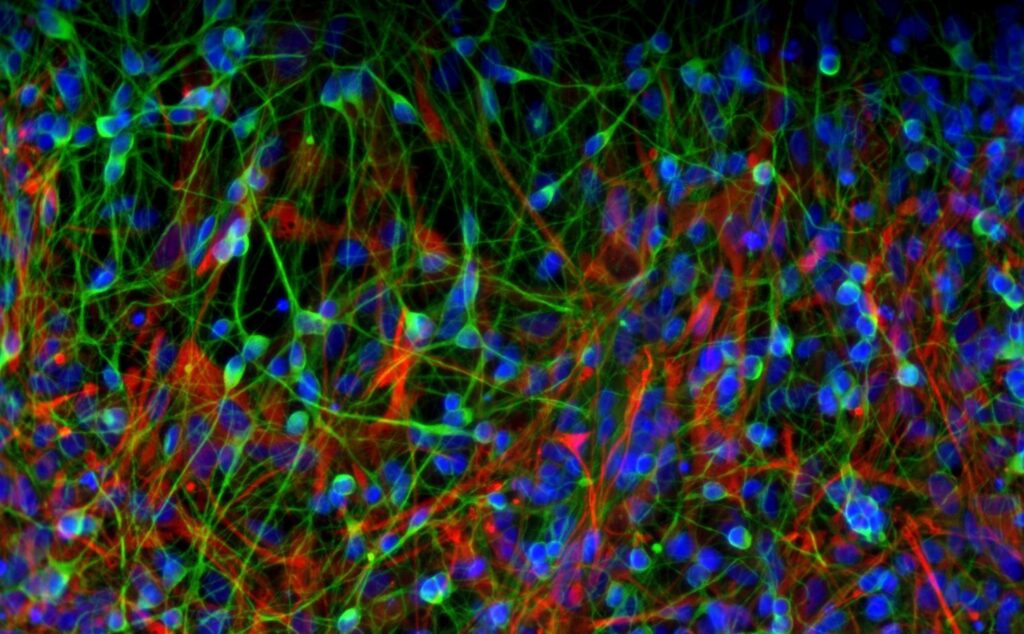 Fluorescent microscopy image showing neural cells with blue nuclei, green neuron projections, and red cell bodies, creating a dense, colorful network.