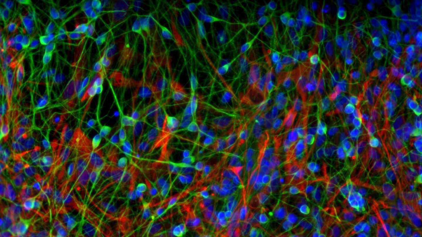 Fluorescent microscopy image showing neural cells with blue nuclei, green neuron projections, and red cell bodies, creating a dense, colorful network.