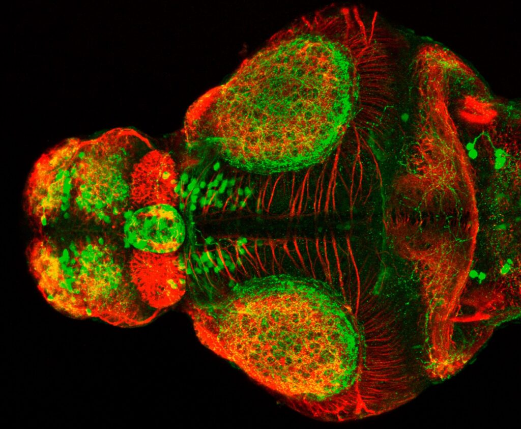 Zebrafish brain