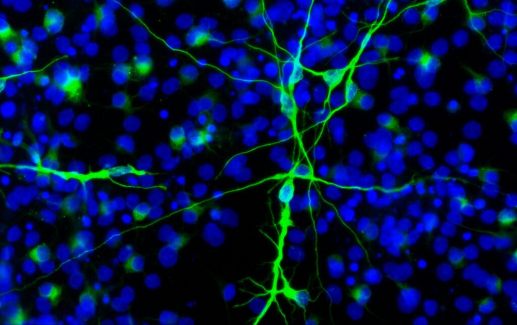 Neurons derived from neural stem cells