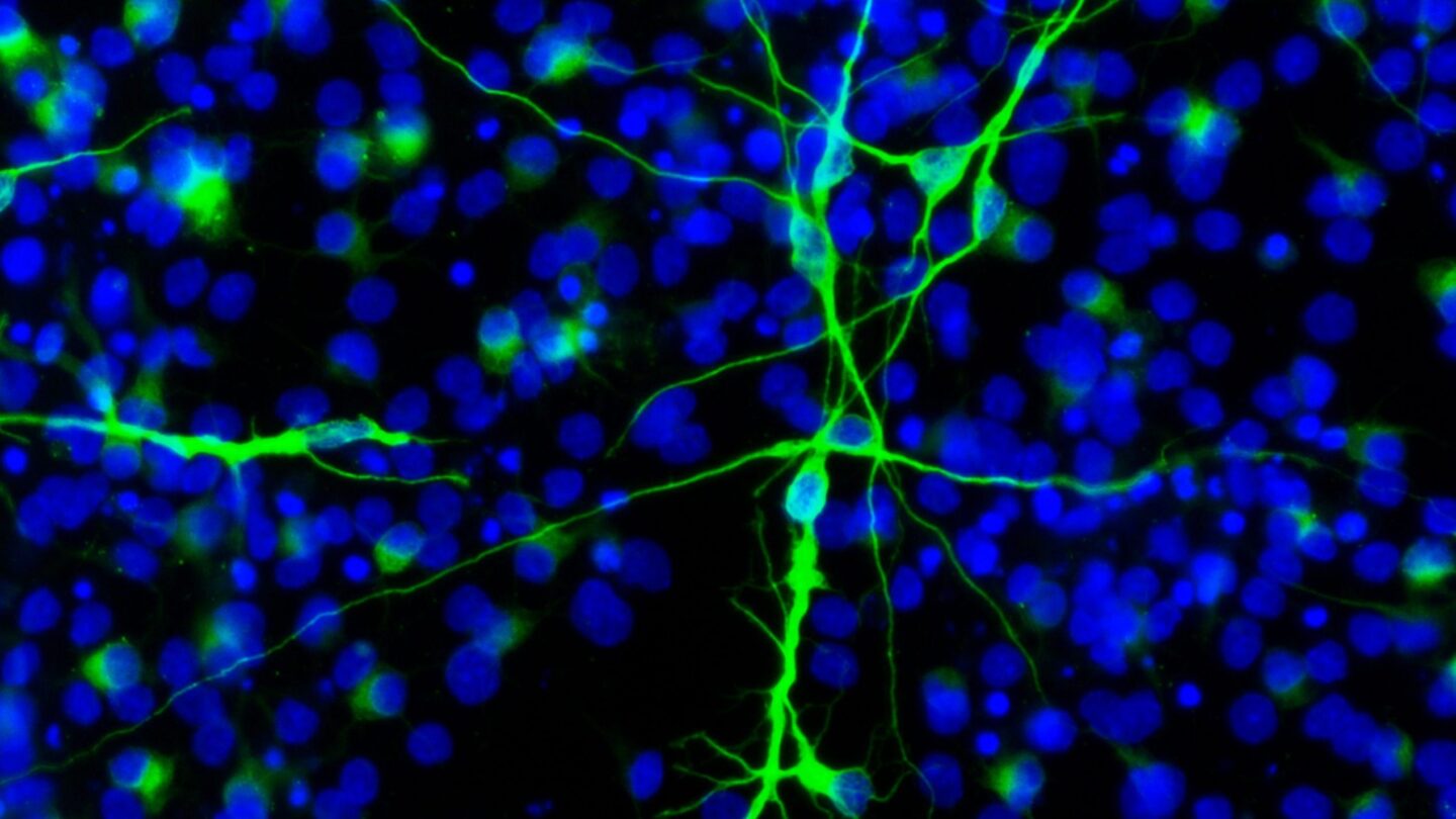 Neurons derived from neural stem cells