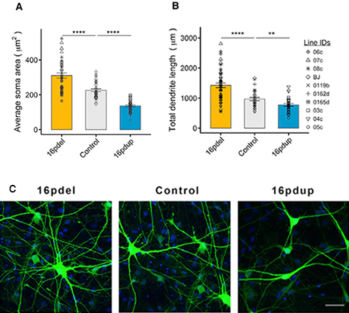 Bar graphs show reduced soma area and dendrite length in 16pdel and 16pdup compared to controls. Below, three images show neuron cultures with green dendrites and blue nuclei for each group.