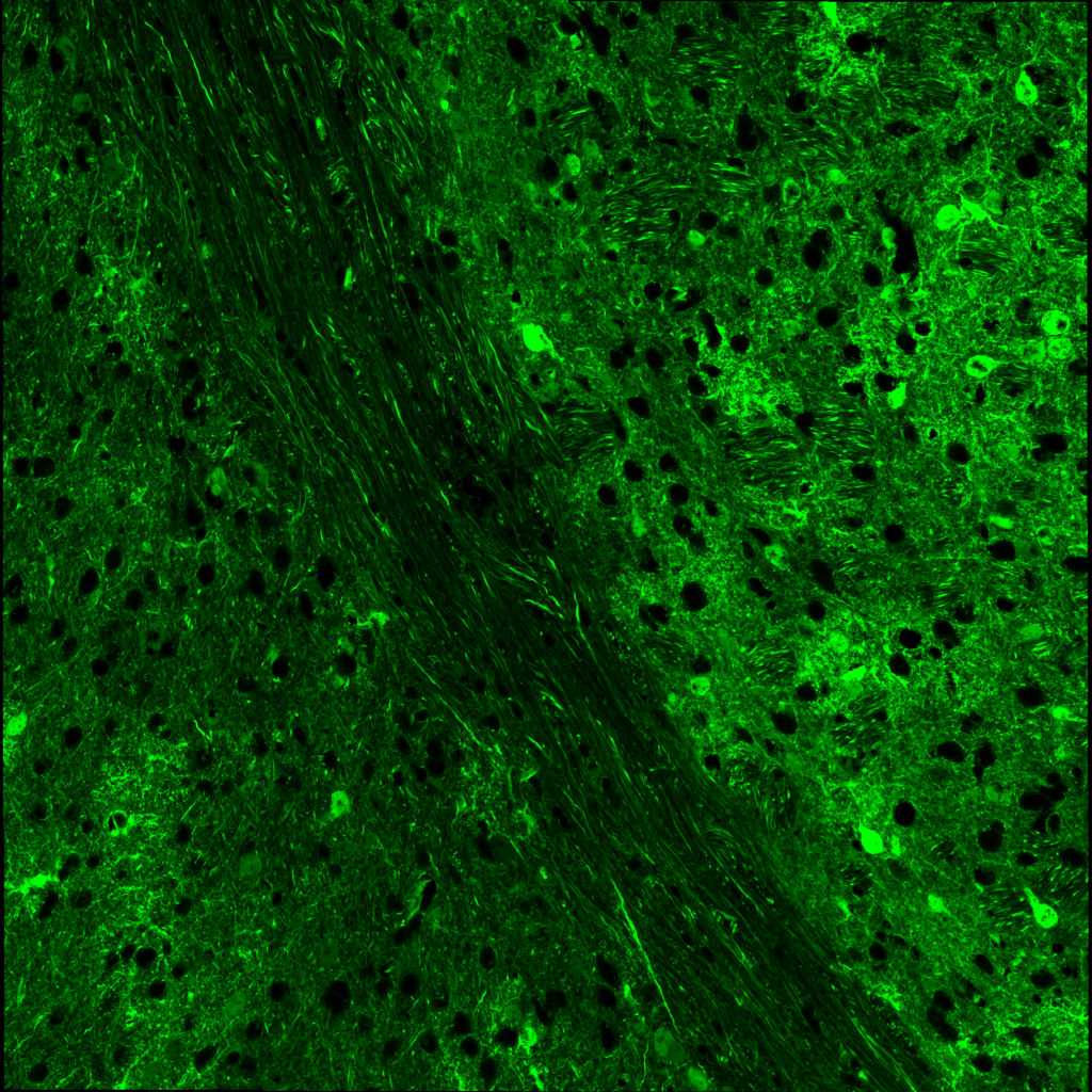 Image of neurons
