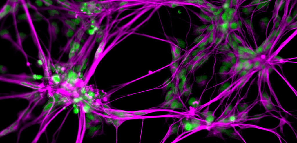 Fluorescent microscopy image showing vibrant pink neural networks with clusters of glowing green cell bodies on a black background.