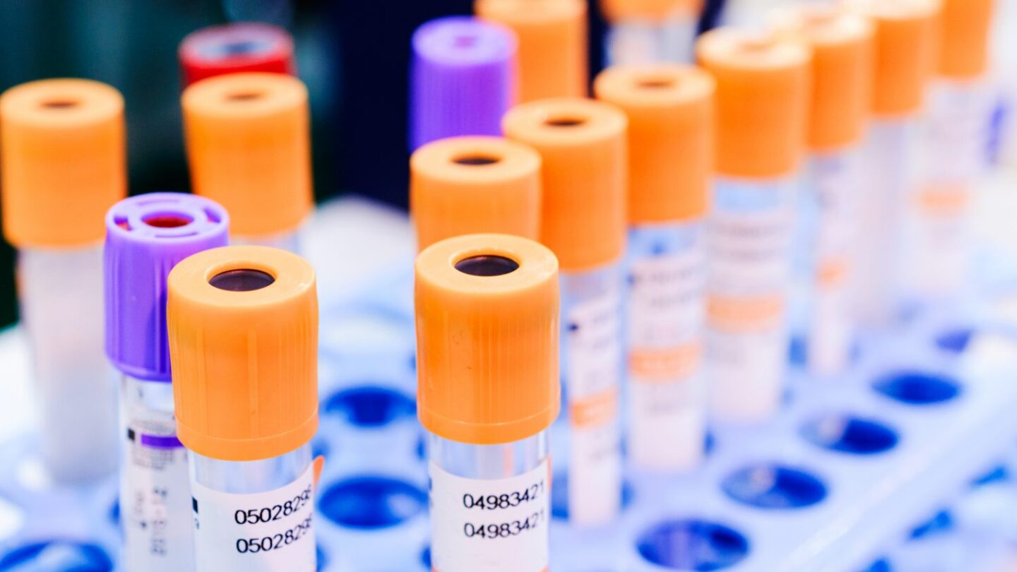 Image of test tubes