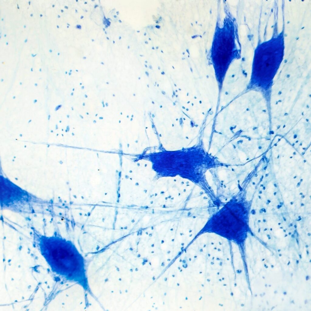 Light micrograph of human brain tissue