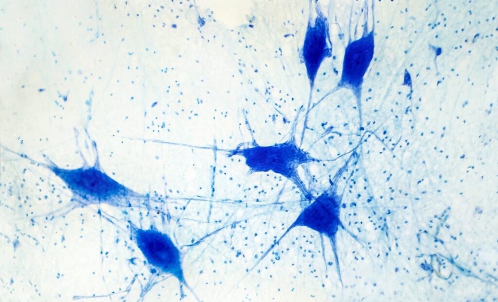 Light micrograph of human brain tissue