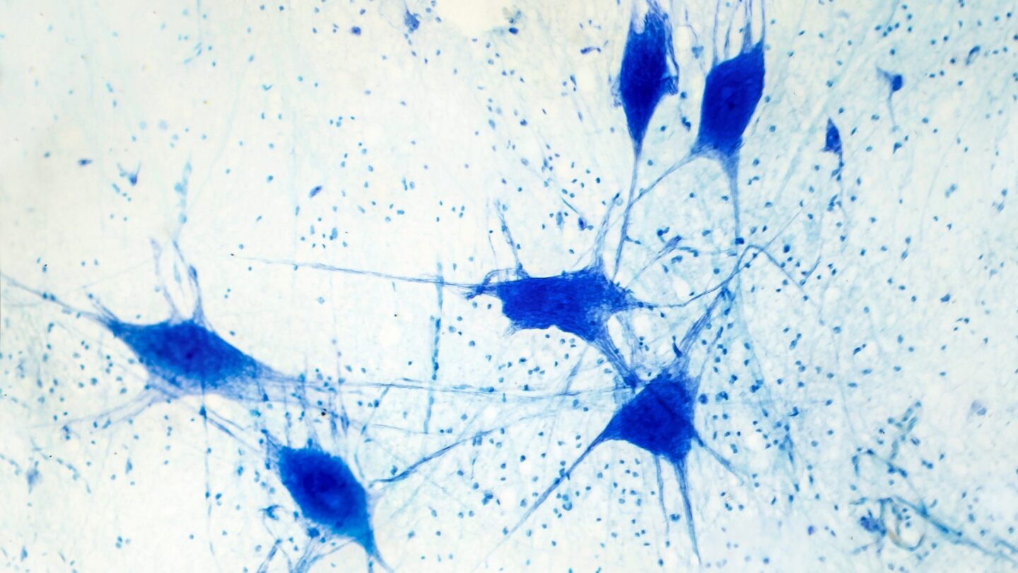 Light micrograph of human brain tissue