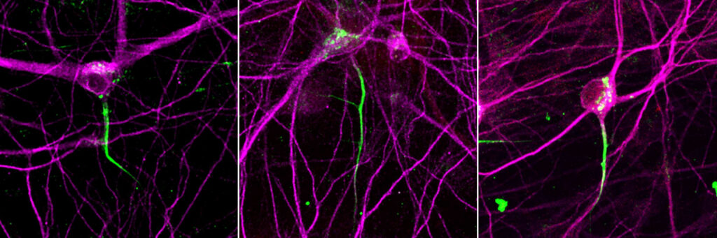Neural cells.