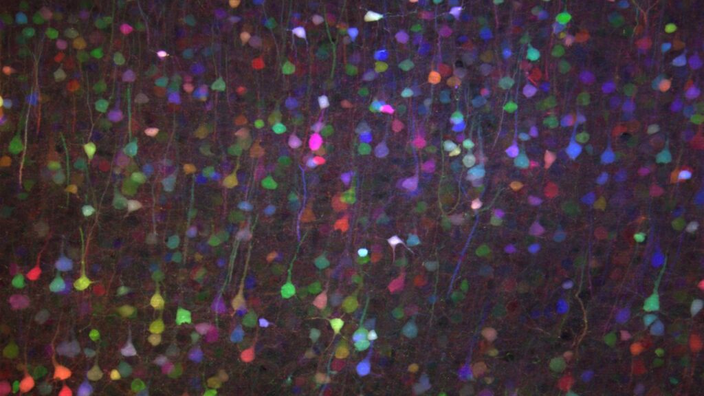 Image of neurons receiving new genes