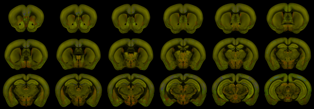 Neural activity