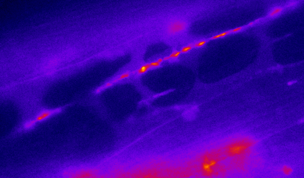 Fluorescent microscopy image of a neural pathway, showing bright orange and red spots along a purple and blue background, highlighting neural activity.