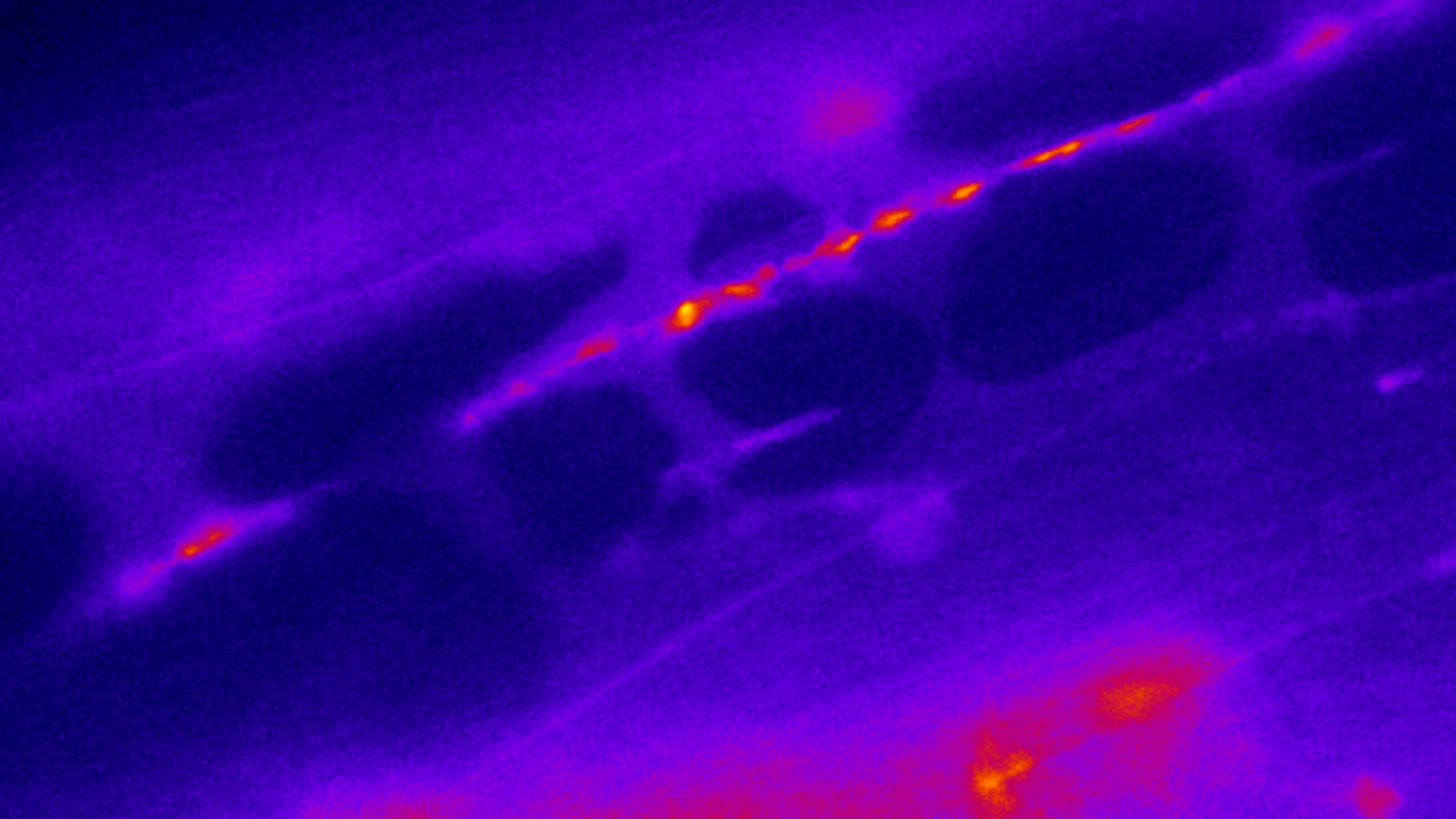 Fluorescent microscopy image of a neural pathway, showing bright orange and red spots along a purple and blue background, highlighting neural activity.