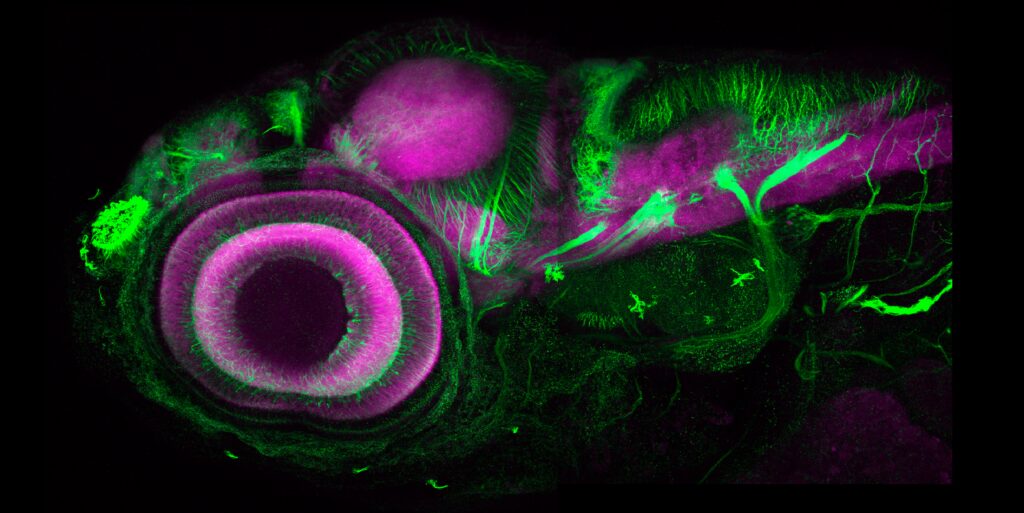 Image of zebra fish embryo