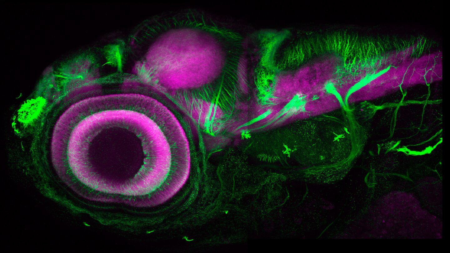 Image of zebra fish embryo