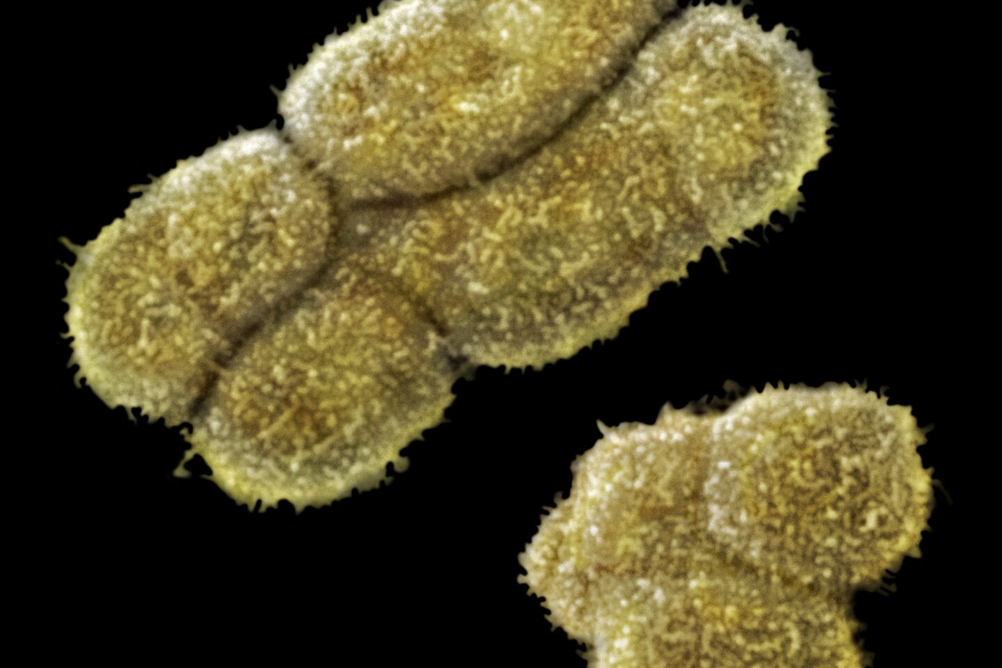 Male Human Sex Chromosomes X and Y SEM