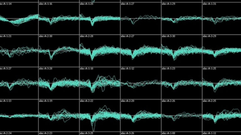 An 8x6 grid of black boxes, each representing different levels of brain functions