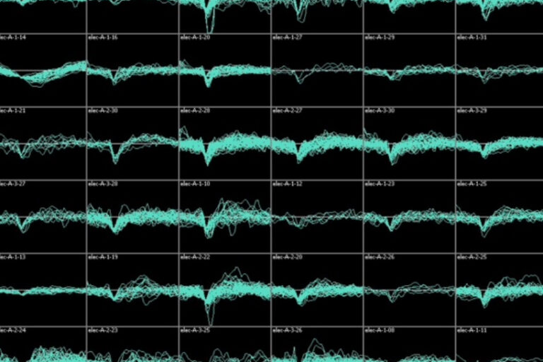 An 8x6 grid of black boxes, each representing different levels of brain functions