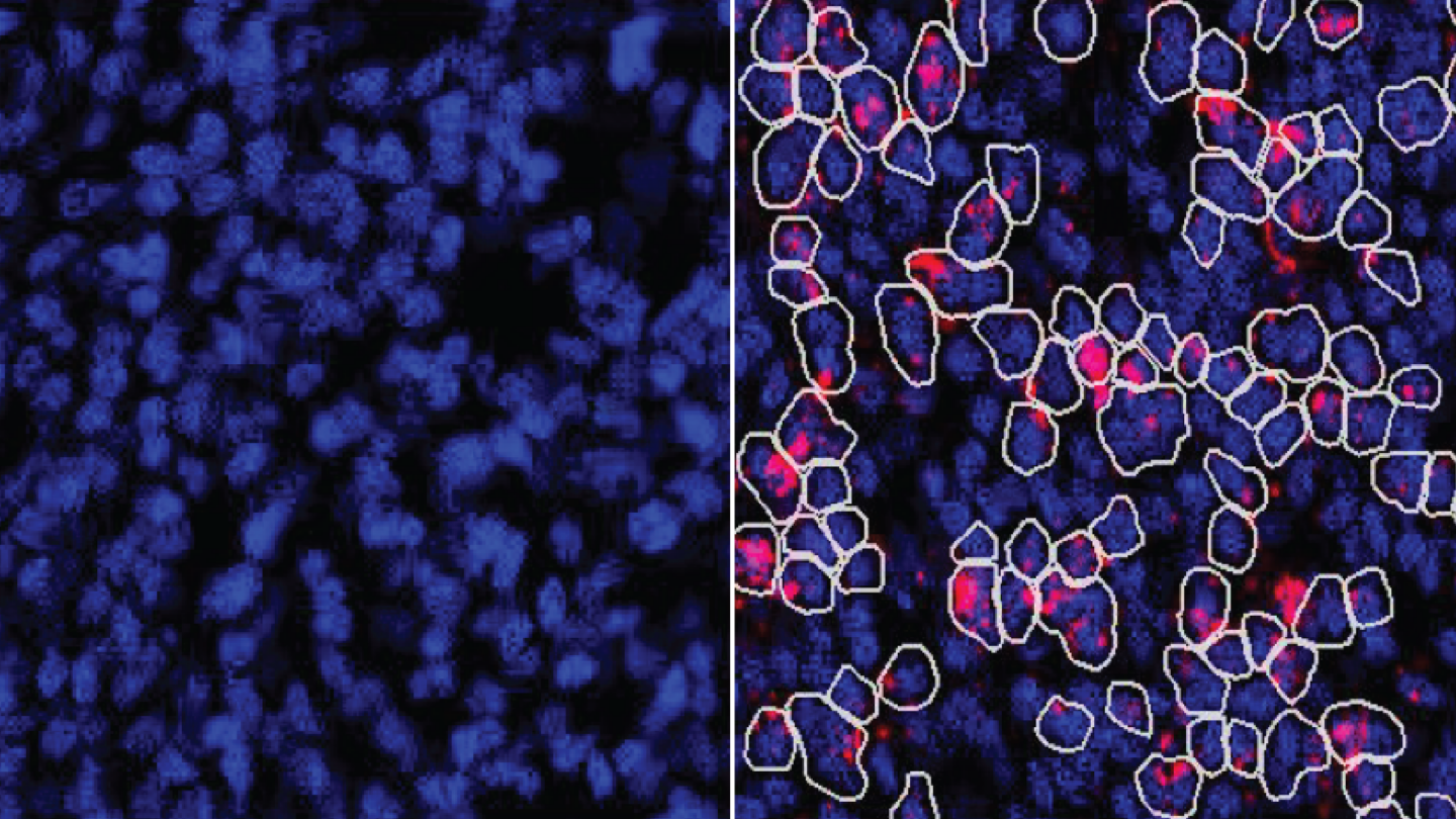 An image comparing the presence of ZBTB18 mRNA and ZBTB18 protein in germinal-zone cells shows that whilst RNA is detectable, the protein is not.
