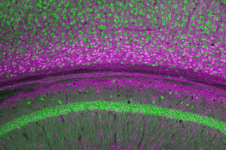 Fluorescent microscopy image of mouse brain tissue, showing layers of cells in green and purple, highlighting neural structures and cell distribution.