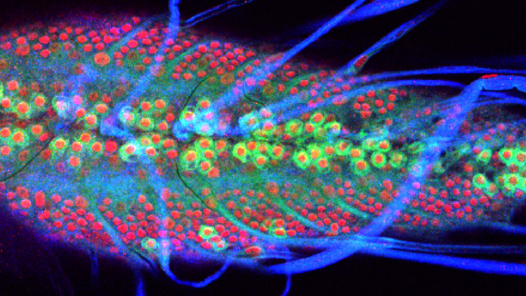 Confocal microscopy image showing neuronal expression of Chd1 in the Drosophila larval brain.