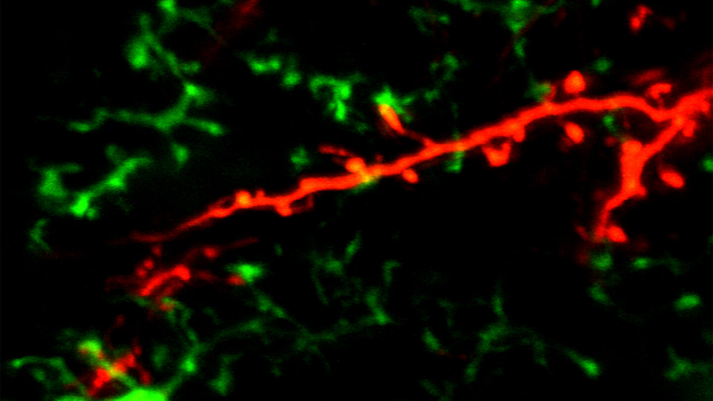 Microglia Spines