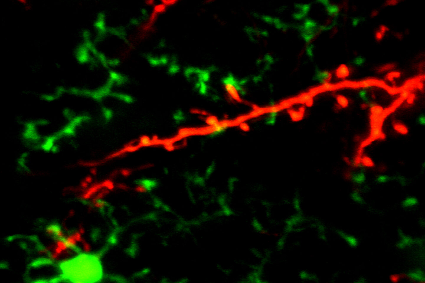 Microglia Spines