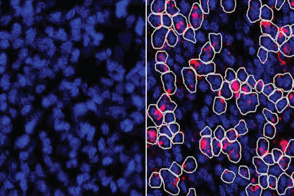 An image comparing the presence of ZBTB18 mRNA and ZBTB18 protein in germinal-zone cells shows that whilst RNA is detectable, the protein is not.