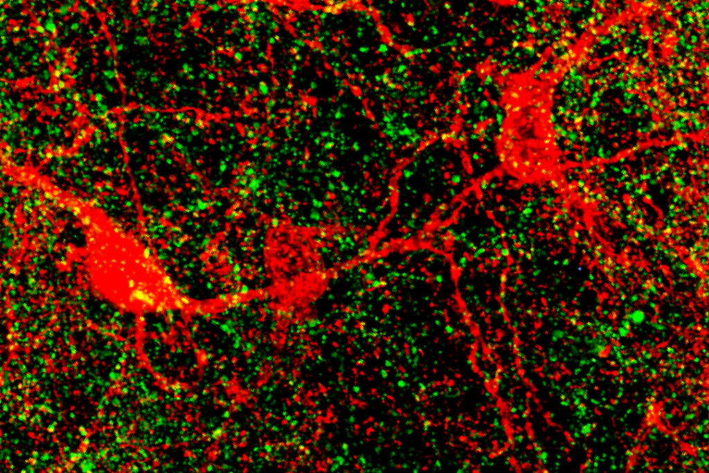 Confocal microscopy image of neurons in the nucleus accumbens of a mouse.
