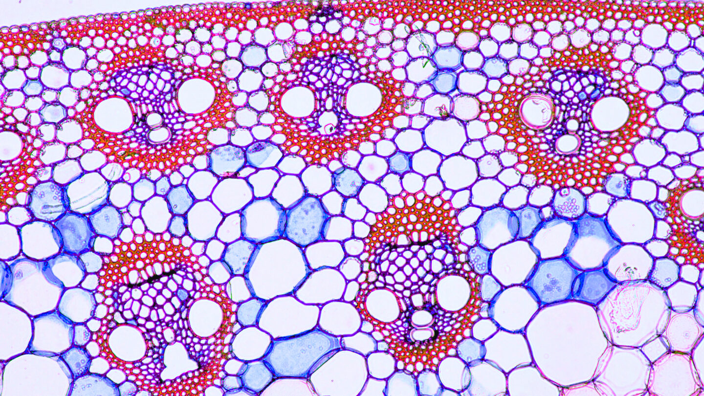 Micrograph image of vascular bundles in a sprout of corn.