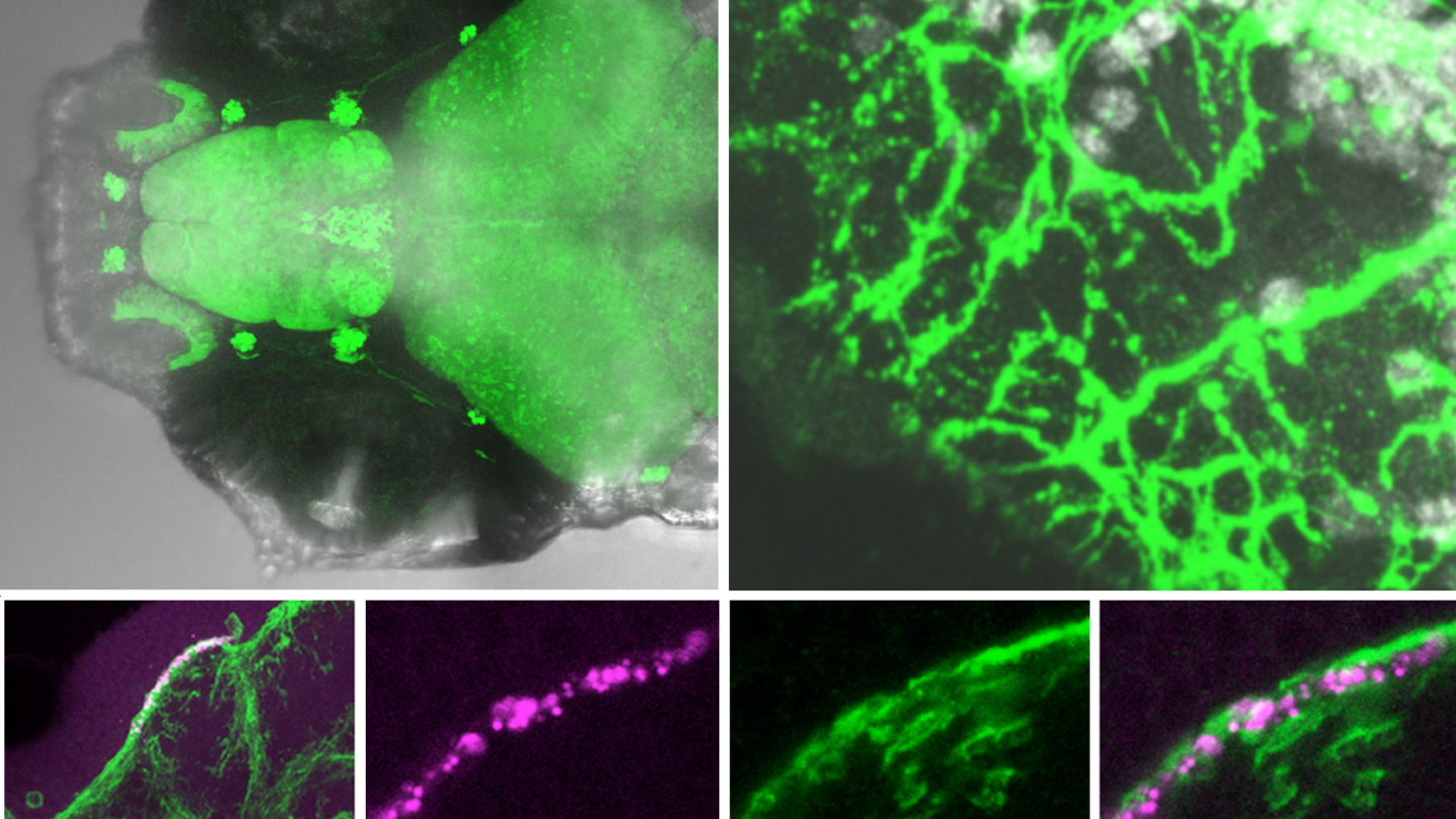 A collage of microscope images showing fluorescent green and magenta neuron structures in a zebrafish brain, highlighting neural networks and synapses in various close-up and wide views.