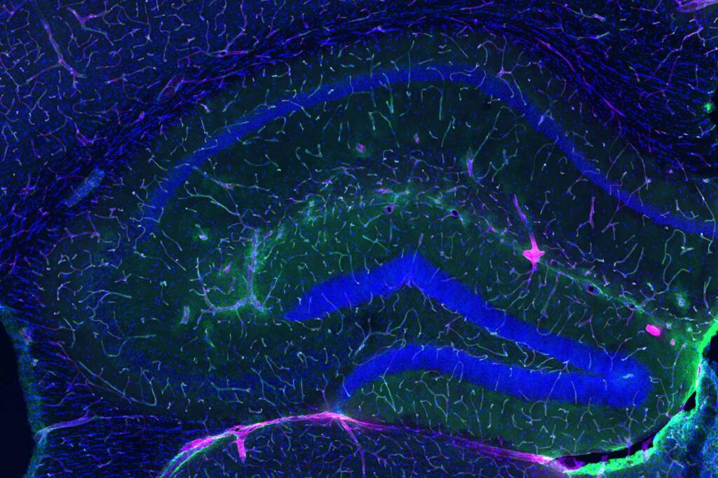 Brain scan showing a healthy blood-brain barrier preventing pink dye from leaking through it.