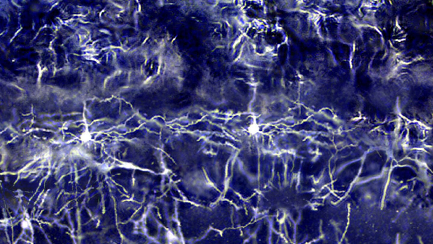 Purple-tinted neurons