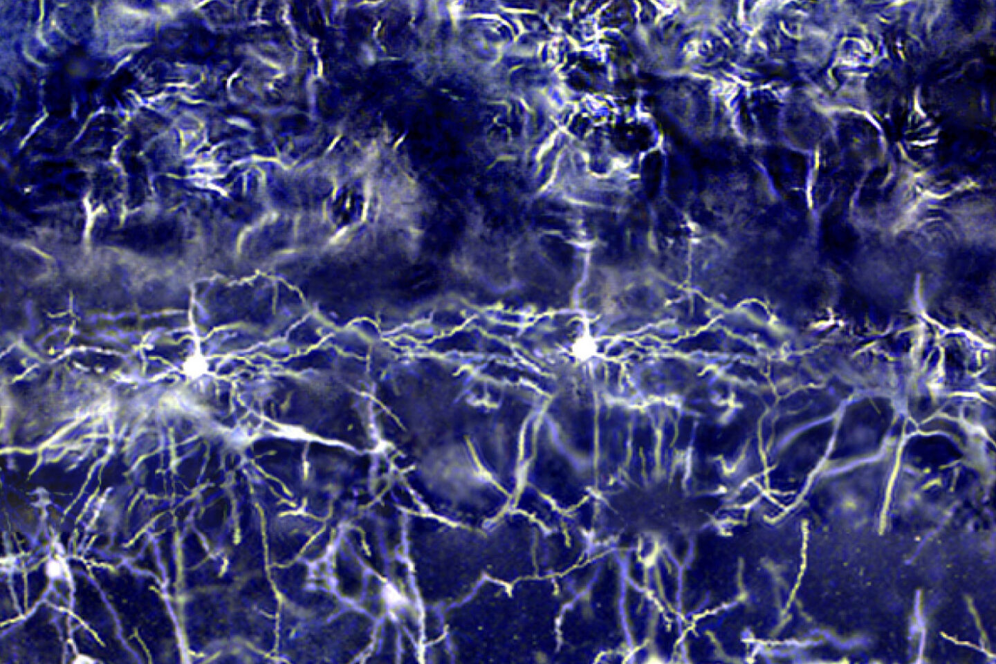 Purple-tinted neurons