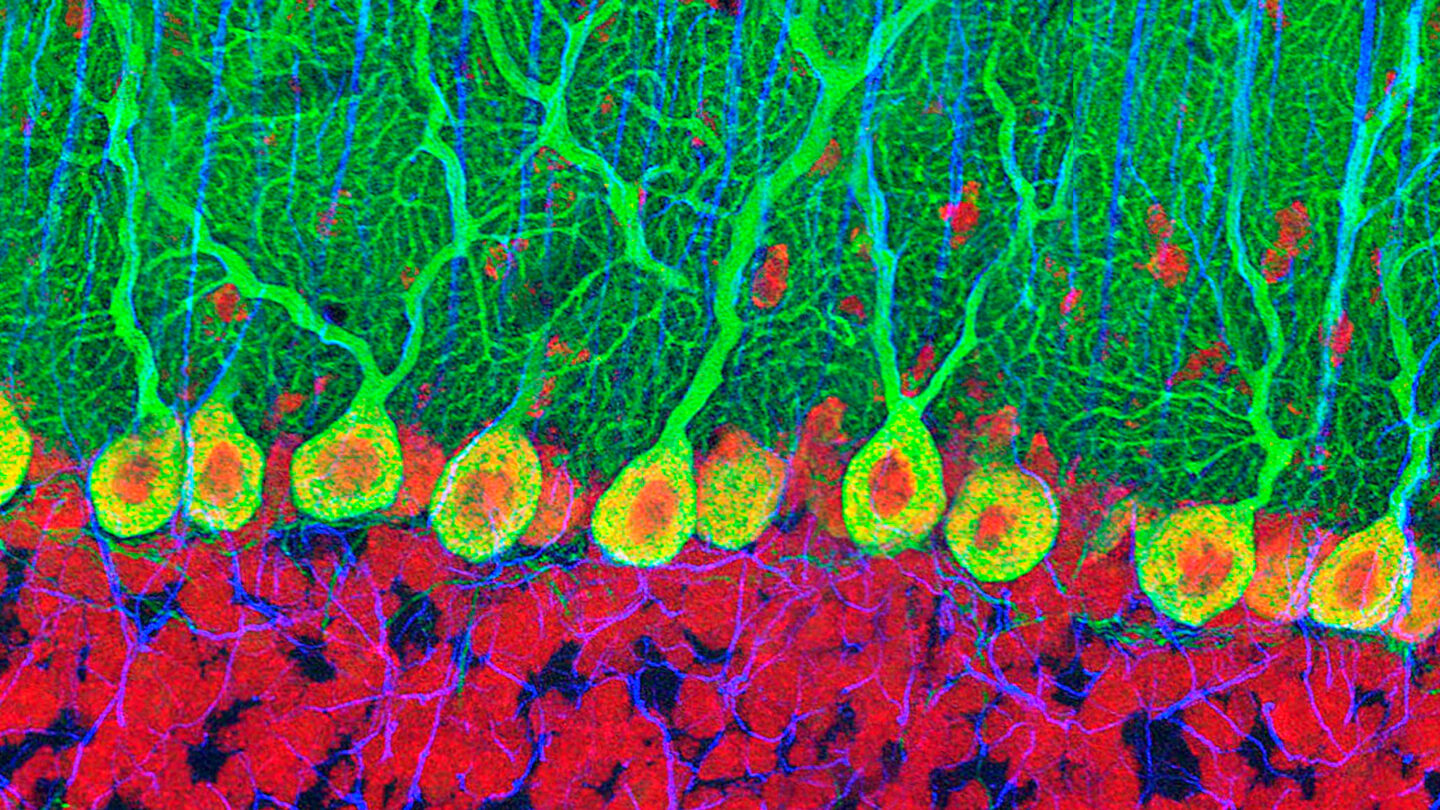 Purkinje nerve cells in the cerebellum.