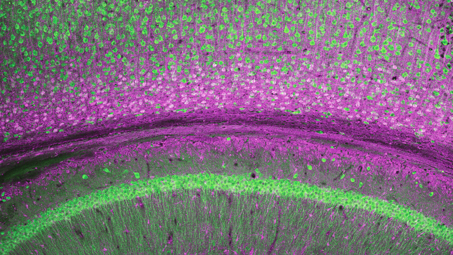 A colorful image of brain cells.