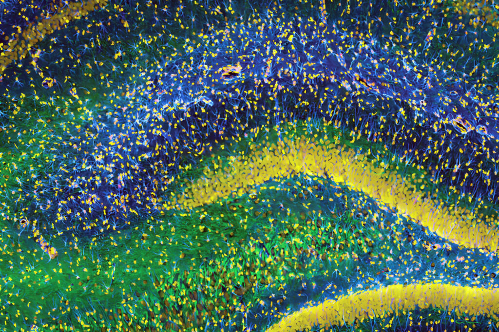 A colorful image of brain cells.