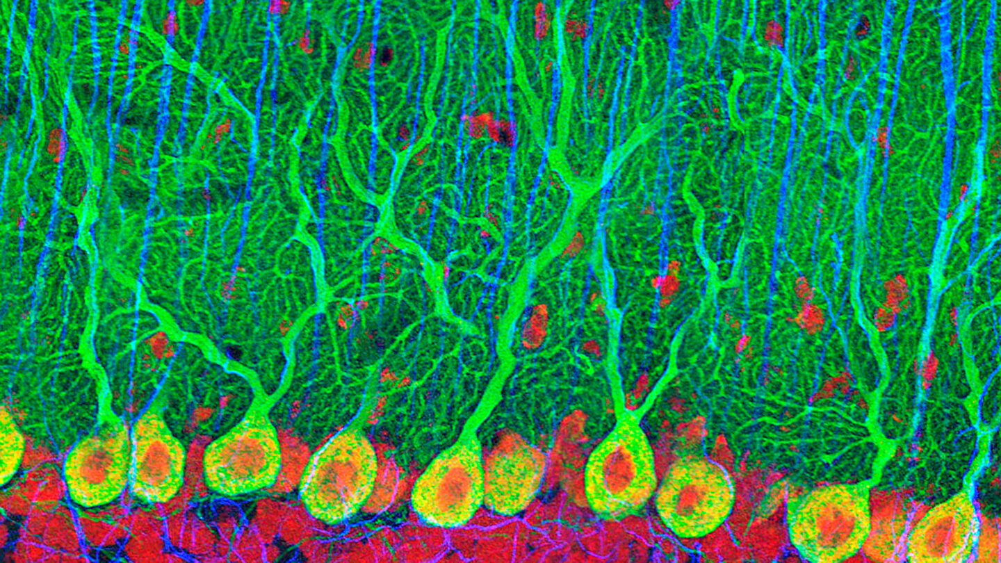 Purkinje nerve cells in the cerebellum.