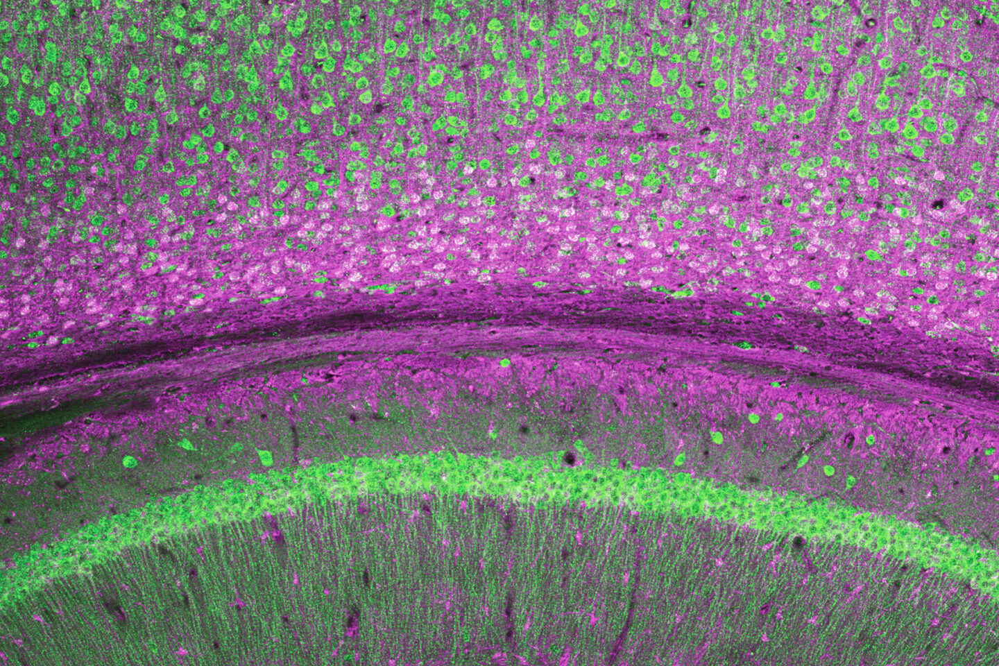 A colorful image of brain cells.