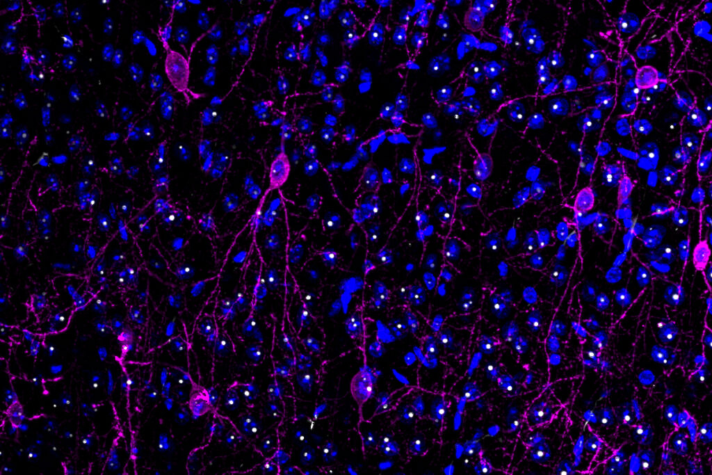 Fluorescent microscopy image showing purple neuron cells with branching extensions and scattered blue nuclei, set against a black background.