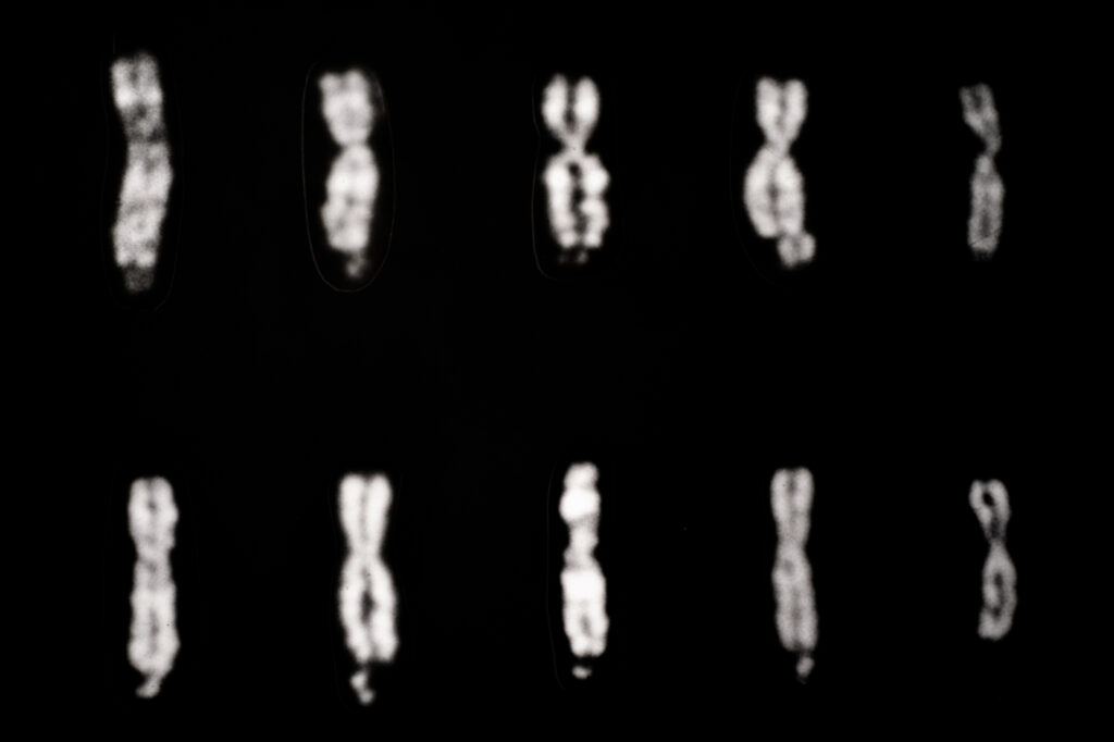 Eleven blurred black and white images of chromosomes are arranged in two uneven rows on a black background. Each chromosome is distinct in shape and brightness.