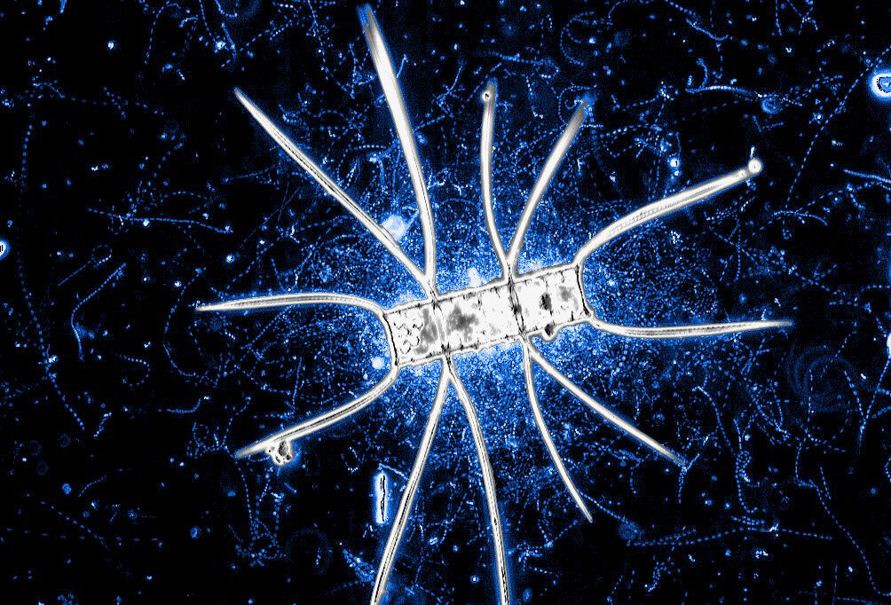 A microscopic view of a spiky, star-shaped microorganism glowing white against a dark blue background filled with smaller, swirling patterns.