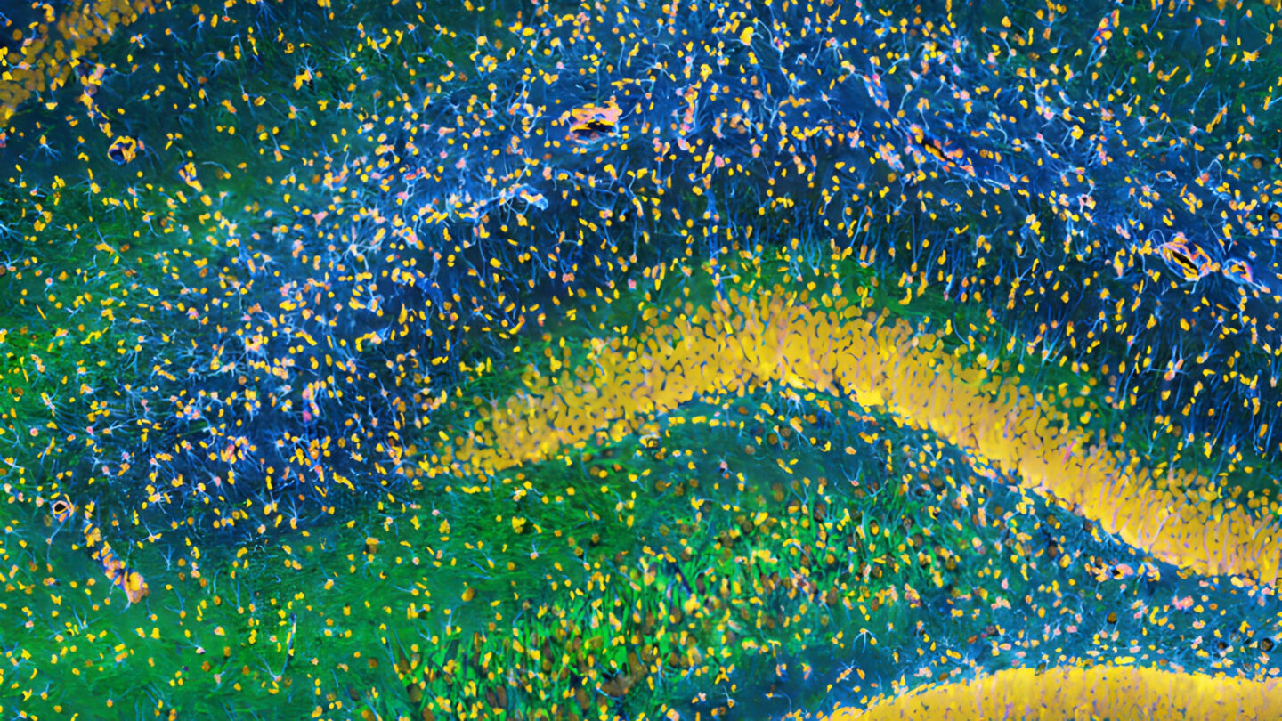 Close-up of colorful abstract patterns resembling wavy layers in green, blue, and yellow, giving a microscopic or cosmic impression with dotted textures throughout the image.