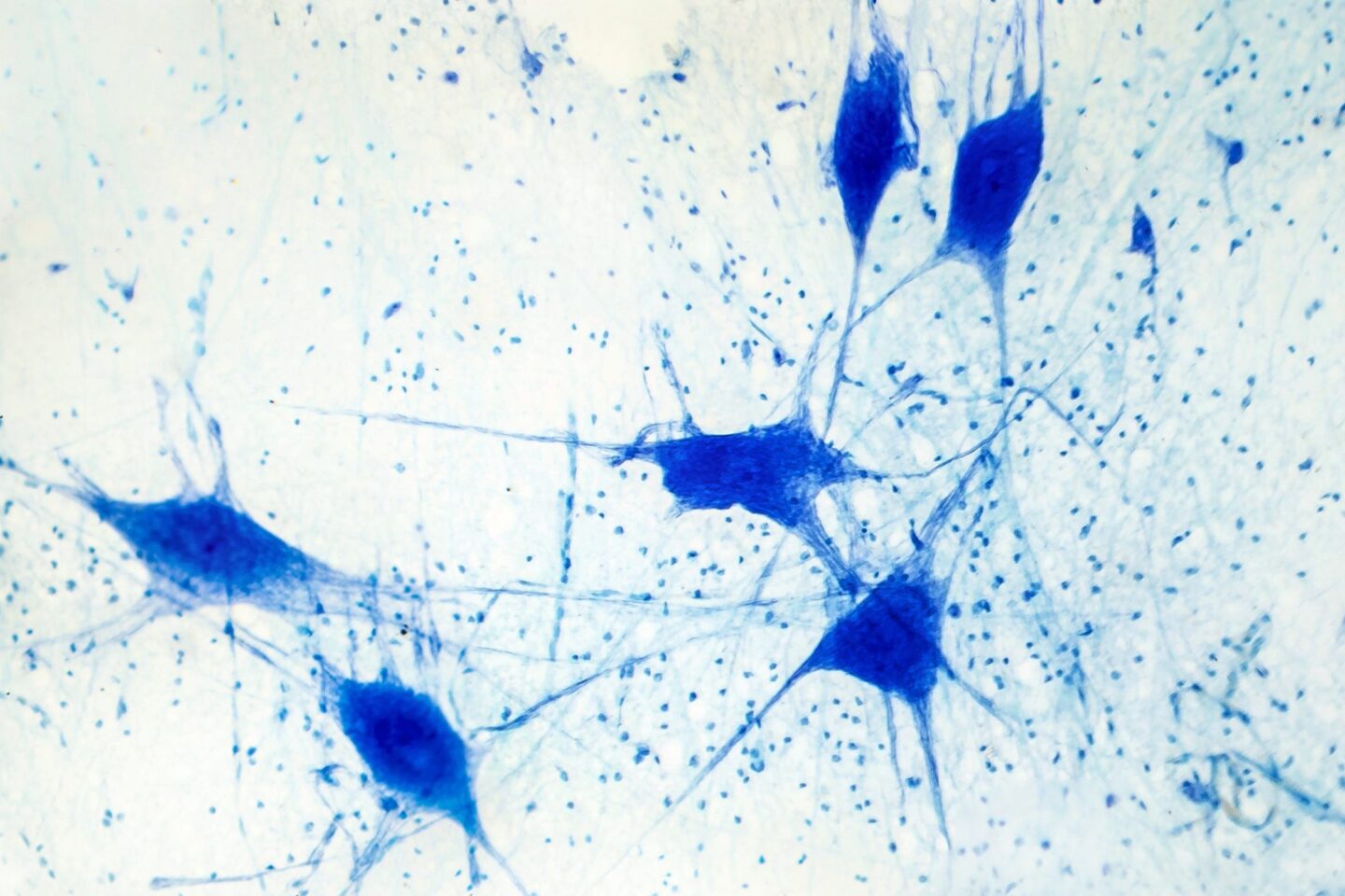 Blue-stained neurons with branching extensions are visible under a microscope on a pale background, illustrating neural cell structure and interconnections.