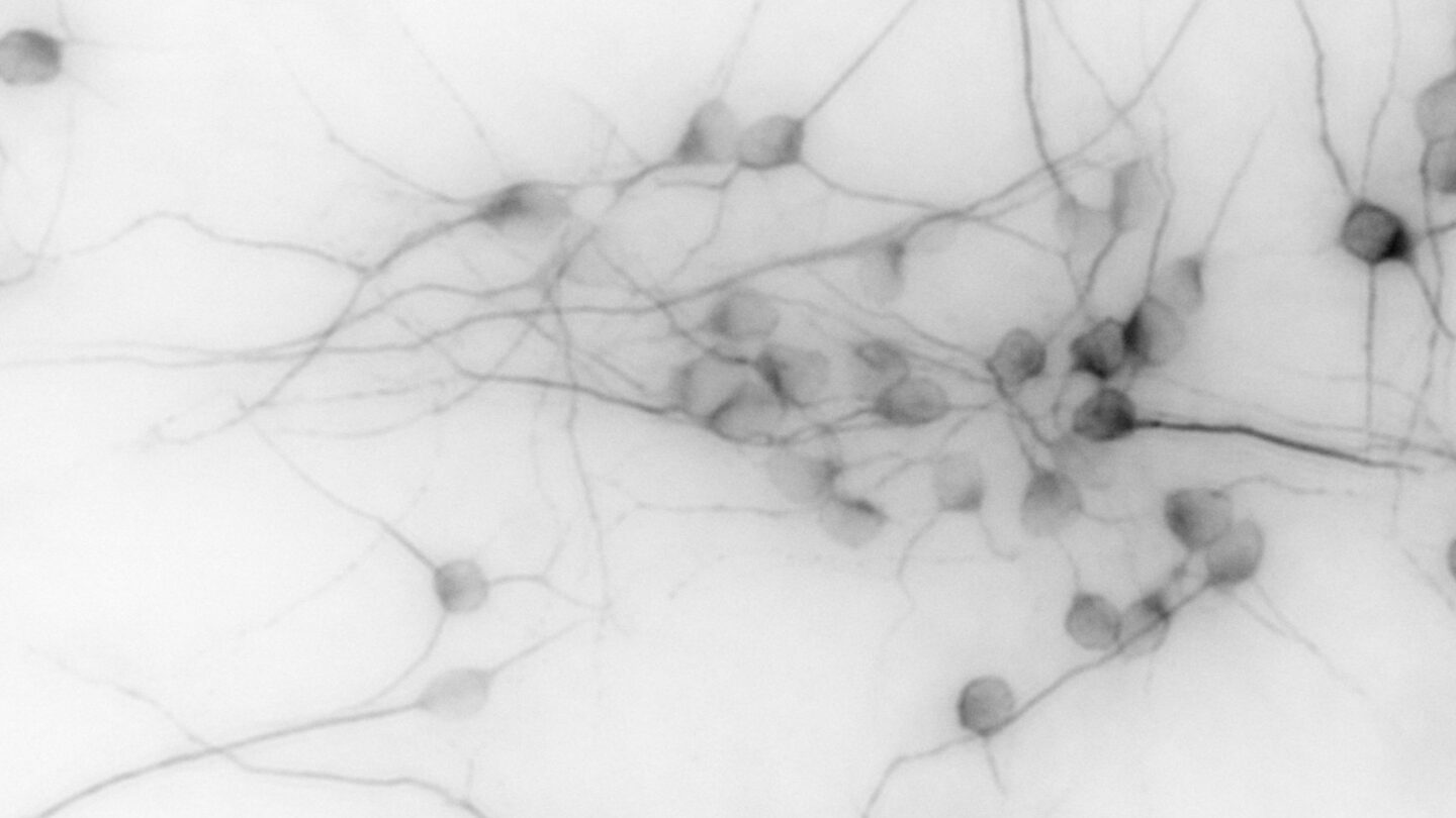Two images comparing sets of neurons with different lengths of neuronal extensions.