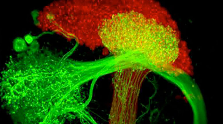 Fluorescence microscopy image showing a network of bright green nerve fibers connecting to a cluster of yellow and red cellular structures.