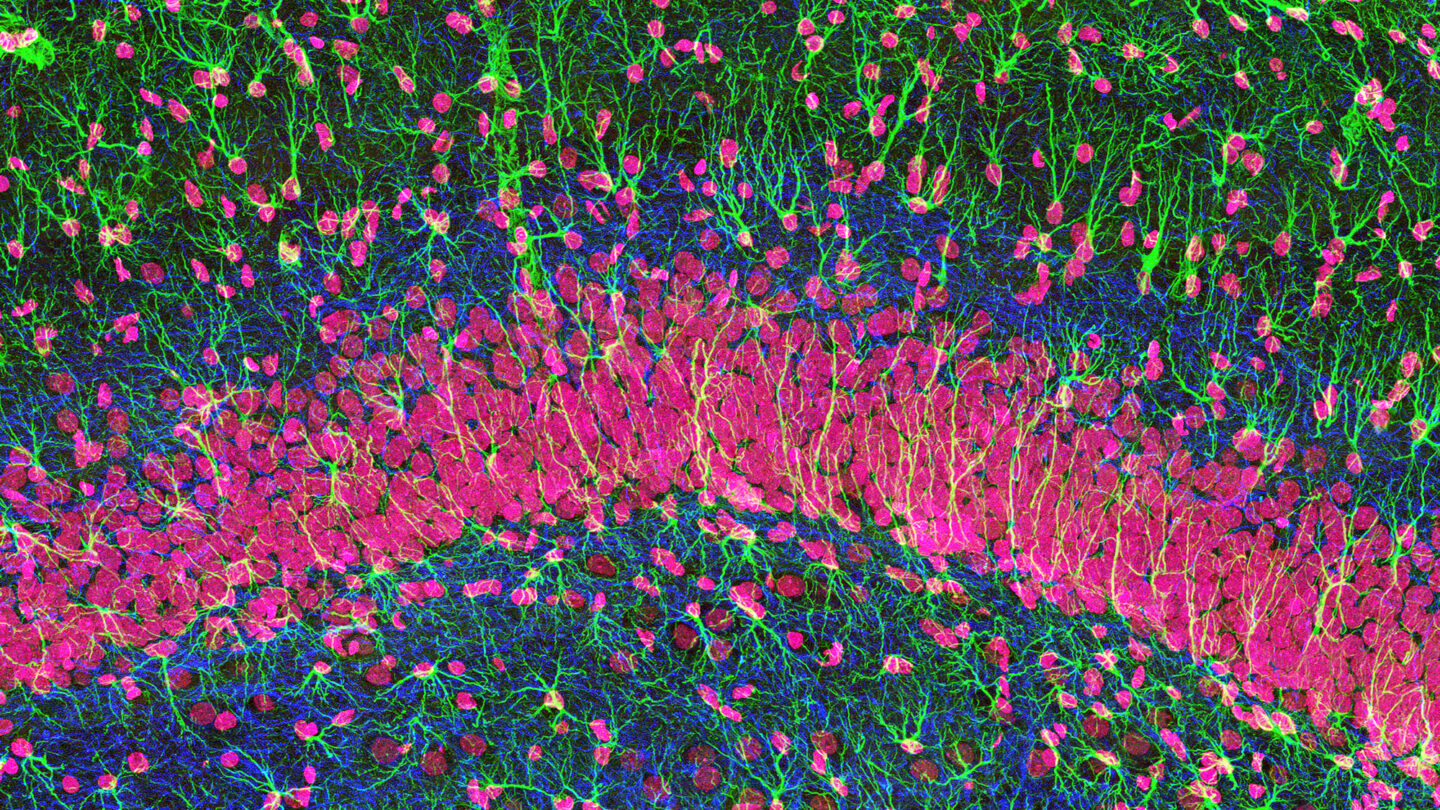 Microscopic image of brain tissue featuring a curved band of magenta cell bodies surrounded by a dense, intricate network of bright green and blue fluorescent filaments.