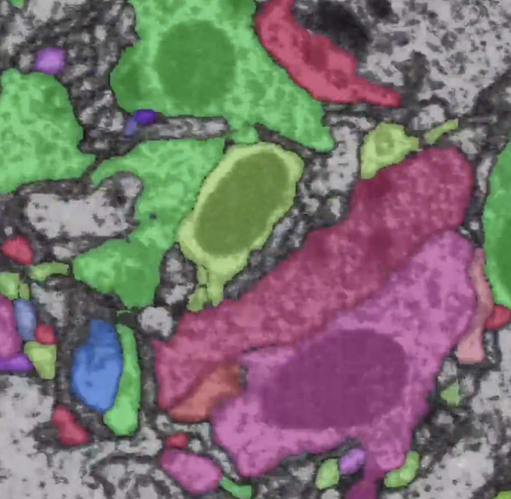 Different colored shapes of neuron connections in brain